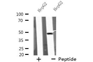 Western blot analysis of extracts from HepG2 cells, using KCNN4 antibody. (KCNN4 antibody  (C-Term))