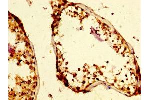 IHC image of ABIN7145750 diluted at 1:500 and staining in paraffin-embedded human testis tissue performed on a Leica BondTM system. (UIMC1 antibody  (AA 161-235))