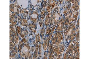 Immunohistochemistry (IHC) image for anti-Myosin VIIA (MYO7A) antibody (ABIN2435035) (Myosin VIIA antibody)