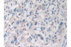 Immunohistochemistry (IHC) image for anti-phosphorylase, Glycogen, Brain (GPBB) (AA 477-731) antibody (ABIN7439942)