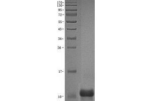 Validation with Western Blot (IGF1 Protein (Transcript Variant 4))