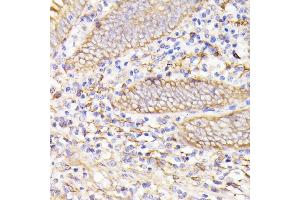 Immunohistochemistry of paraffin-embedded human appendix using PSMG1 antibody (ABIN7269593) at dilution of 1:100 (40x lens).