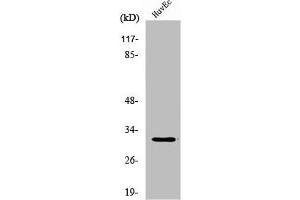 Western Blot analysis of HuvEc cells using DIO3 Polyclonal Antibody