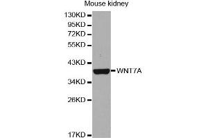 Western Blotting (WB) image for anti-Wingless-Type MMTV Integration Site Family, Member 7A (WNT7A) antibody (ABIN1876613) (WNT7A antibody)