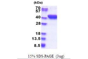 Mesoderm Development Candidate 1 (MESDC1) (AA 1-362) protein (His tag)