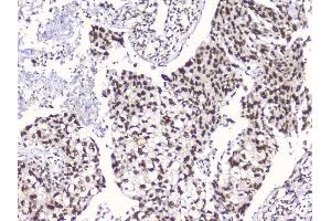 IHC analysis of RbAp48 using anti-RbAp48 antibody (ABIN5692929).