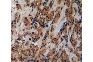 Used in DAB staining on fromalin fixed paraffin- embedded breast cancer tissue (Fibrillin 2 antibody  (AA 1550-1791))