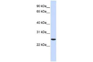 UBE2K antibody used at 0. (UBE2K antibody  (Middle Region))