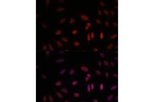 Immunofluorescence analysis of U-2 OS cells using WDR18 antibody (ABIN7271354) at dilution of 1:100. (WDR18 antibody  (AA 243-432))