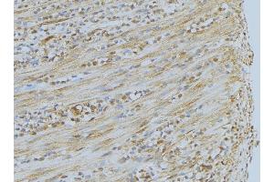 ABIN6275351 at 1/100 staining Mouse muscle tissue by IHC-P.