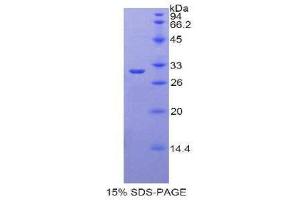 SDS-PAGE (SDS) image for Lactoperoxidase (LPO) (AA 351-589) protein (His tag) (ABIN2121509) (LPO Protein (AA 351-589) (His tag))