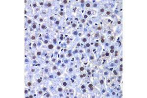 Immunohistochemistry of paraffin-embedded mouse liver using PRKDC antibody.