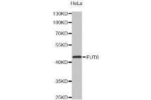 Western Blotting (WB) image for anti-Fucosyltransferase 6 (Alpha (1,3) Fucosyltransferase) (FUT6) antibody (ABIN1872749)