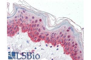 Immunohistochemistry (IHC) image for anti-Prolyl 4-Hydroxylase, alpha Polypeptide I (P4HA1) (Internal Region) antibody (ABIN190847)