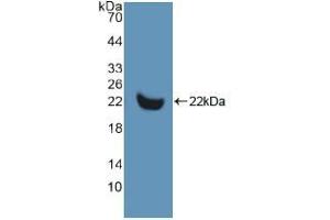 Western blot analysis of recombinant Human MMP13. (MMP13 antibody  (AA 290-468))