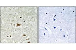 Immunohistochemistry analysis of paraffin-embedded human brain tissue, using Smad2 (Ab-220) Antibody. (SMAD2 antibody  (AA 186-235))