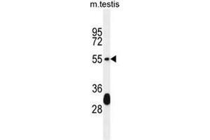 KT33A Antibody (N-term) western blot analysis in mouse testis tissue lysates (35µg/lane). (Keratin 33A antibody  (N-Term))