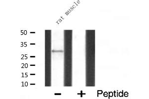 Western blot analysis of MRPL10 expression in Rat muscle lysate (MRPL10 antibody  (C-Term))
