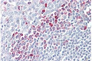 Anti-PARP6 antibody IHC staining of human tonsil. (PARP6 antibody  (AA 431-480))