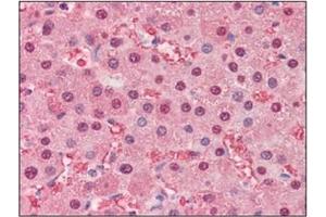Immunohistochemistry (IHC) image for anti-Fatty Acid Binding Protein 1, Liver (FABP1) (AA 1-127), (N-Term) antibody (ABIN317518) (FABP1 antibody  (N-Term))