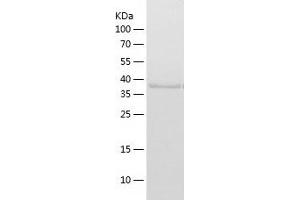 Western Blotting (WB) image for Reticulon 4 Interacting Protein 1 (RTN4IP1) (AA 41-396) protein (His tag) (ABIN7288133) (RTN4IP1 Protein (AA 41-396) (His tag))