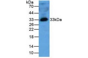 Western blot analysis of Human Plasma Tissue. (MBL2 antibody  (AA 130-248))