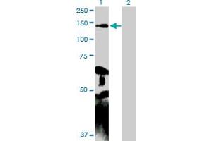 Western Blot analysis of MYLK expression in transfected 293T cell line by MYLK MaxPab polyclonal antibody. (MYLK antibody  (AA 1-992))
