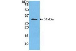 Western blot analysis of recombinant Human CA3. (CA3 antibody  (AA 2-260))