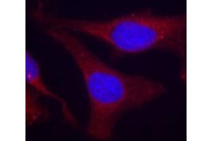 Immunofluorescence staining of methanol-fixed Hela cells, using Phospho-PTPN6-Y536 antibody. (SHP1 antibody  (pTyr536))