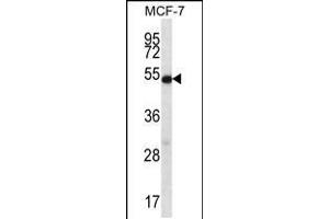 Western blot analysis in MCF-7 cell line lysates (35ug/lane). (Coilin antibody  (AA 157-186))