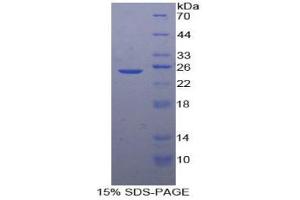 SDS-PAGE analysis of Human SDF2 Protein.