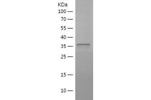 Western Blotting (WB) image for Polyhomeotic Homolog 2 (Drosophila) (PhC2) (AA 701-810) protein (His-IF2DI Tag) (ABIN7282638) (PHC2 Protein (AA 701-810) (His-IF2DI Tag))