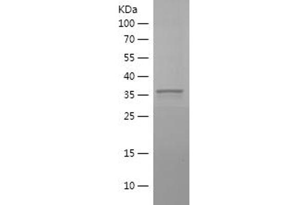 PHC2 Protein (AA 701-810) (His-IF2DI Tag)