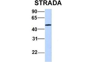 Host:  Rabbit  Target Name:  STRADA  Sample Type:  721_B  Antibody Dilution:  1. (STRADA antibody  (C-Term))