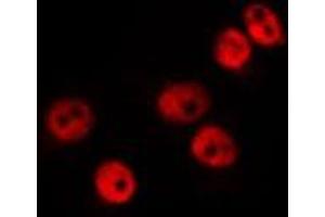 ABIN6275261 staining HepG2 by IF/ICC. (MDFI antibody  (Internal Region))