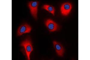 Immunofluorescent analysis of p39 staining in HeLa cells. (p39 (Center) antibody)