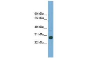 Image no. 1 for anti-MAX Dimerization Protein 1 (MXD1) (AA 681-730) antibody (ABIN6746140) (MXD1 antibody  (AA 681-730))