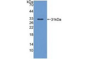 Detection of Recombinant PLCe1, Mouse using Polyclonal Antibody to Phospholipase C Epsilon 1 (PLCe1) (PLCE1 antibody  (AA 1-250))