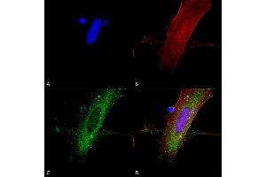 Immunocytochemistry/Immunofluorescence analysis using Mouse Anti-GluN2A/NR2A Monoclonal Antibody, Clone S327A-38 (ABIN2483897). (NMDAR2A antibody  (AA 75-325) (FITC))