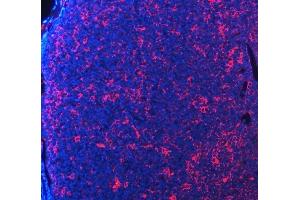 IF analysis of PDCD1 using anti-PDCD1 antibody (ABIN5518784). (PD-1 antibody  (N-Term))