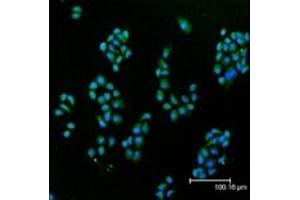 Immunofluorescent analysis (confocal) staining of HeLa cells using Cu/Zn SOD pAb (green), nuclei are stained in blue pseudocolor using DRAQ5. (SOD1 antibody)