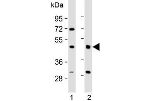 Western blot testing of human 1) brain and 2) lung lysate with HIPPI antibody at 1:2000. (IFT57 antibody  (AA 159-193))