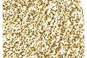 ABIN6269073 at 1/100 staining Human gastric tissue by IHC-P.