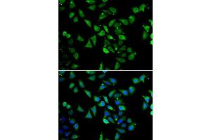 Immunofluorescence (IF) image for anti-Eukaryotic Translation Initiation Factor 3 Subunit C (EIF3C) (AA 694-913) antibody (ABIN6140055)