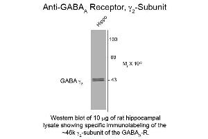 Western Blot of Anti-GABA(A) Receptor gamma 2 (Rabbit) Antibody - 112-401-C81 Western Blot of Rabbit Anti-GABA(A) Receptor gamma 2 Antibody.