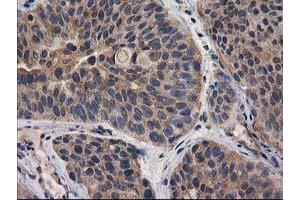 Image no. 17 for anti-Destrin (Actin Depolymerizing Factor) (DSTN) antibody (ABIN1497910) (Destrin antibody)