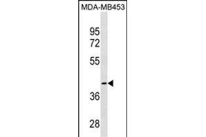 CCBL1 Antibody (C-term) (ABIN1537137 and ABIN2849997) western blot analysis in MDA-M cell line lysates (35 μg/lane).