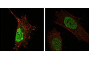 Confocal immunofluorescence analysis of Hela (left) and L-02 (right) cells using MDM4 mouse mAb (green). (MDM4-binding Protein antibody)