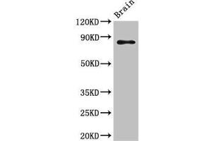 Western Blot Positive WB detected in: Mouse brain tissue All lanes: GIT1 antibody at 3. (GIT1 antibody  (AA 470-642))