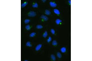 IF analysis of CPI17 alpha using anti-CPI17 alpha antibody (ABIN5518865). (CPI-17 antibody  (AA 30-126))